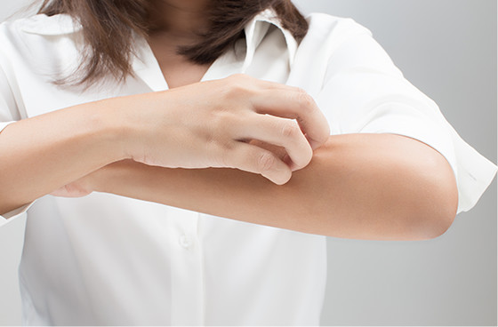 写真：アレルギー対策に困っている